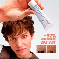 Avene Cleanance Comedomed Peeling, złuszczający krem na nasilone wypryski, 40 ml