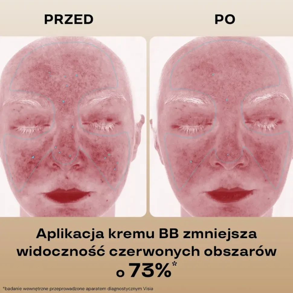 BasicLab Beauties, nawilżający krem,BB SPF15, Honey, 33 ml