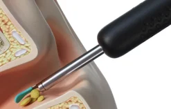 Bebird EarSight R1, otoskop z kamerą do czyszczenia uszu, biały, 1 szt.