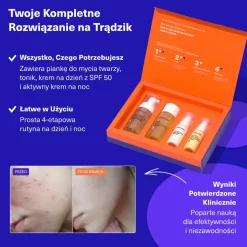 Dermz Laboratories Vitumisil Anti-Acne Set, pianka, 100 ml + toner, 150 ml, krem na dzień, 50 ml + krem na noc, 50 ml