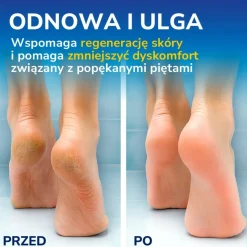 Dr. Scholl's, krem regenerujący na popękane pięty, 120 ml