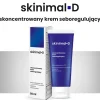 Skinimal D, skoncentrowany krem seboregulujący, 50 ml