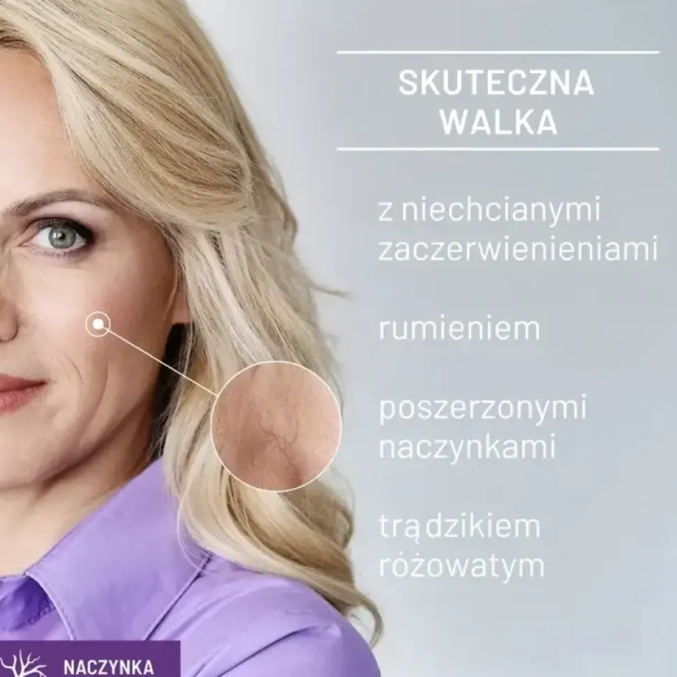 Sylveco Dermo Naczynka, peeling kwasowy na naczynka, 30 ml