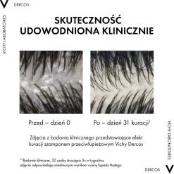 Vichy Dercos DS, szampon przeciwłupieżowy, włosy suche, 390 ml